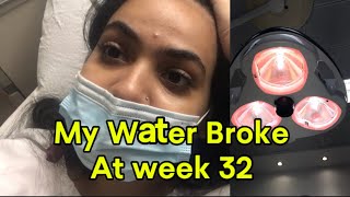 My water broke at week 32 pregnancyjourney [upl. by Airom]