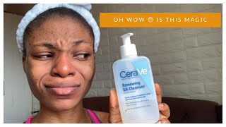 I Used Cerave Renewing SA Cleanser for 7 Days Cerave Review on Acne Did it work [upl. by Alisan695]