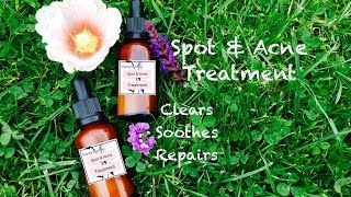 DIY Spot amp Acne Treatment [upl. by Neelehtak]