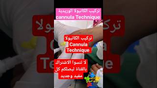 تركيب الكانيولا cannula Technique shorts [upl. by Nordna503]