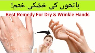 Best Remedy For Dry amp Wrinkle Hands In UrduHindi [upl. by Alverta]