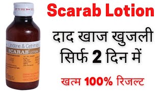 दाद खाज खुजली  खुजली से परेशान  Scarab Lotion Benefits  Scarab Lotion use in hindi [upl. by Prince]