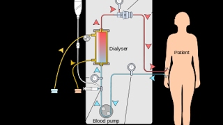 lhémodialyse Le mécanisme daction الية العمل تصفية الدم [upl. by Trueman]
