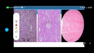 Histology Slides Series Episode 13  Histology of the Urinary System [upl. by Penhall]