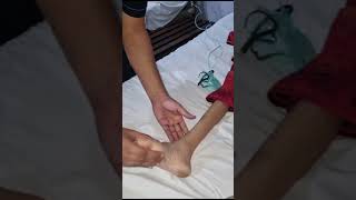 Clonus  Ankle clonus clonus NeurologyExamination paces uppermotorneuron [upl. by Mathia]