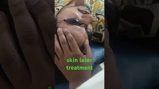 skin laser treatment besthairtransplant besthairPRP besthairGFC [upl. by Rizan424]