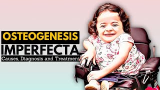 OSTEOGENESIS IMPERFECTA OI Causes Signs and Symptoms Diagnosis and Treatment [upl. by Emelita]