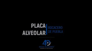 Colocación Placa Alveolar [upl. by Hellene]