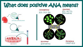 Antinuclear Antibodies ANA test and their patterns  ANA test  What does ANA test positive mean [upl. by Nawj343]