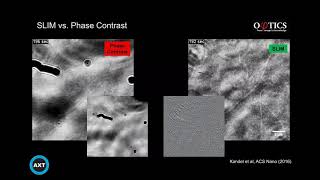 LabelFree Quantitative Phase Imaging of Live Cells and Tissue [upl. by Wehttam511]