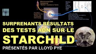 Surprenants résultats ADN du xénomorphe quotStarchildquot alien par Lloyd Pye VOSTFR [upl. by Itida139]