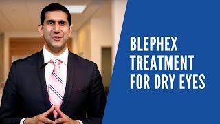 BlephEx Treatment for Dry Eyes [upl. by Waterer]