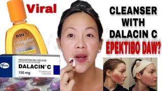 Cleanser with dalacin c [upl. by Enirac111]