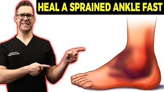 High Ankle Sprain Treatment Causes Exercises amp Recovery Time [upl. by Eisiam]