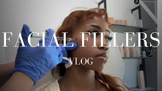 CHEEK  CHIN FILLER VLOG [upl. by Hadnama]