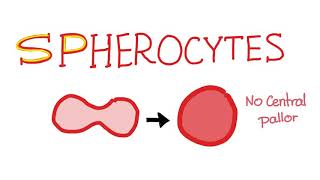 Spherocytes [upl. by Eedolem]