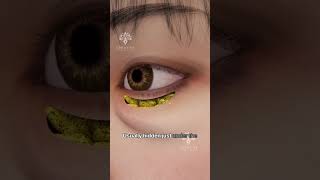 How Does Puffy Eye Surgery Work shorts viralvideo  Creativelearning3d [upl. by Iosep]