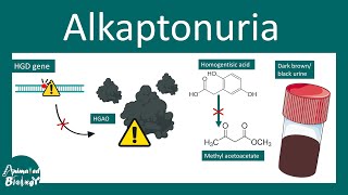 Alkaptonuria  Alkaptonuria Causes Signs and Symptoms Diagnosis  Treatment  Black urine disease [upl. by Leibarg]