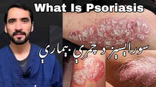 What Is Psoriasis  In Pashto By Dr Adnan Khan [upl. by Hiller]