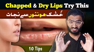 Chapped Lips in Winter  10 Simple Tips to Cure Cracked or Dry Lips in UrduHindi [upl. by Yuji]