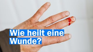 Wie funktioniert die Wundheilung [upl. by Hanni]