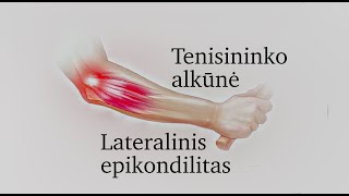 Lateralinis epikondilitas arba tenisininko alkūnė tennis elbow [upl. by Merril]