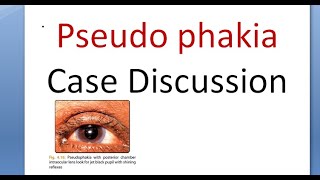 Ophthalmology Pseudophakia History Taking Examination Case Presentation Discussion IOL [upl. by Jedidiah]