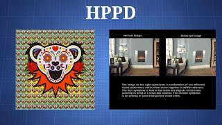 Hallucinogen Persisting Perception Disorder HPPD What You Need To Know [upl. by Cressida263]