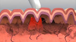 Animation of Collagen Re Growth [upl. by Eninnej]