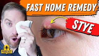 Super FAST Home Remedy For An Eyelid Stye [upl. by Mitinger]