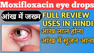 Moxifloxacin Eye Drops Hindi  Moxifloxacin And Dexamethasone Eye Drops [upl. by Dyanne]