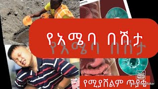 የአሜባ በሽታAmoebiasis 🦠Amoebic Dysentery Lecturing Video Causes Sign and symptomRxDx amp prevention [upl. by Nils]