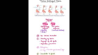 TracheoEsophageal fistula [upl. by Aisilef]