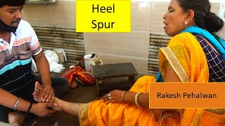 Reliable Amazing Chiropractic Adjustment India Treating Heel Spur Of Woman By Indian Chiropractor [upl. by Assilam146]