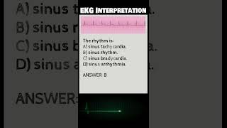 EKG\ECG Interpretation Practice Exam for Nursing NCLEX [upl. by Hercules]