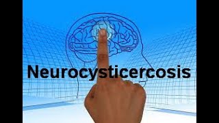 Neurocysticercosis NCC Types Clinical manifestations Diagnosis and Management [upl. by Atirahs]