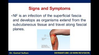 Dermatologic emergencies 5 Necrotizing Fasciitis NF [upl. by Aurelia]