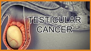 Testicular CancerTumors [upl. by Teodoro]