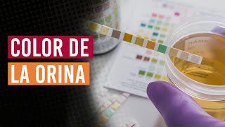 ¿Cuál es el color de tu orina ¿Qué significa [upl. by Anilasor]