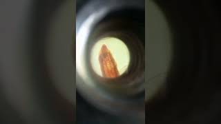 Fasciola hepatica Permanent Slide zoology bscworldamarsingh shorts shortvideo [upl. by Gwendolyn]