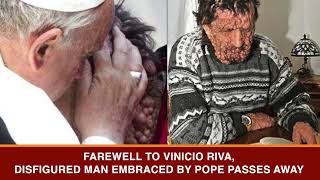 Farewell to Vinicio Riva disfigured man embraced by Pope passes away  SW NEWS [upl. by Eldin]