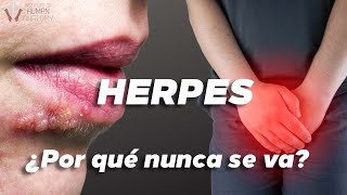 Herpes  El Regalo Que Sigue Dando [upl. by Rufe]