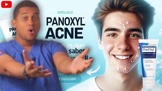 PanOxyl ACNE  3 Cosas Antes de Usarlo ¡ALERTA [upl. by Ecadnak]