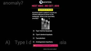 NEET MDS  INICET MDS  PSC  BDS  Most Important Questions neetmds2025 mdsprep [upl. by Oirasec]