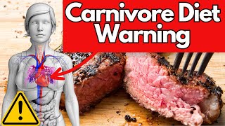 Is a Carnivore Diet Bad for High Cholesterol and Heart Health Dietitian Reveals The TRUTH [upl. by Colman]