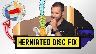 Disc Herniation Rehab Made Easy In 3 Steps [upl. by Moll]