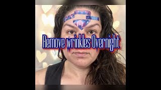 Get Rid Of Forehead Wrinkles Overnight Naturally [upl. by Hairehcaz676]