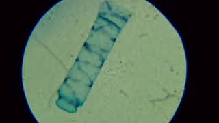 Parfocal and Parcentral as seen through a Microscope SD 480p [upl. by Maiah]