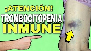 TROMBOCITOPENIA INMUNE💢 FISIOPATOLOGÍA SINTOMAS CAUSAS DIAGNÓSTICO y TRATAMIENTO📌 [upl. by Lenoyl688]