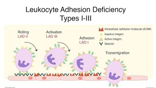 Defects in Leukocyte Function  Acute and Chronic Leukocyte Adhesion Deficiency [upl. by Patrizio]